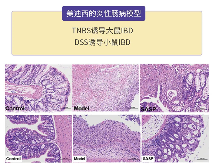 合乐HL8的炎性肠病模型.png